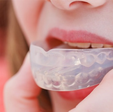 Sports Mouthguards Calgary | Calgary Dentist | Scenic Acres Dental | NW Calgary