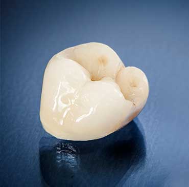 NW Calgary Dental Crowns | Scenic Acres Dental Centre | NW Calgary